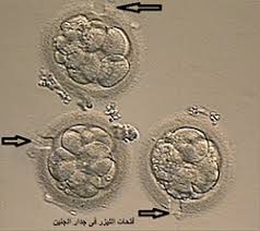 علامات ثبوت الاجنه بعد الترجيع - اسباب ثبوت الاجنه 2948