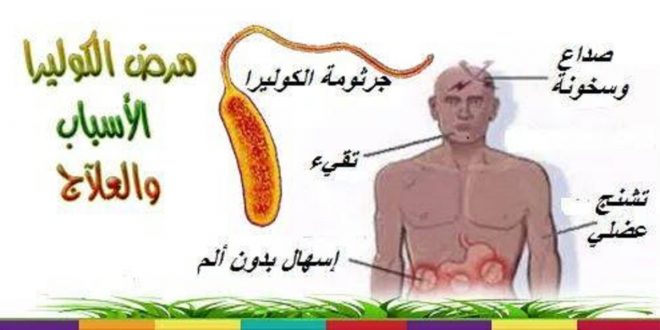 علاج مرض الكوليرا - طريقة للتخلص من الطاعون 12666