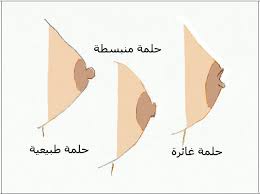 انواع ثدي المراة بالصور - صور عن اختلاف انواع ثدي المراة 2312 4