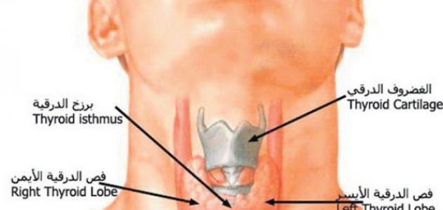 علاج خمول الغدة الدرقية , ماهو مرض الغدة