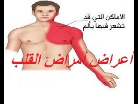 اعراض امراض القلب - ما يشعر به مريض القلب 5090 6