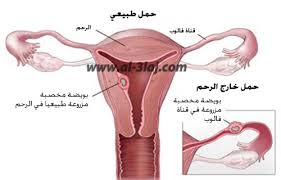 متى تبدا اعراض الحمل - كيفي يتم تحديد مدة بدء اعراض الحمل 2314 2