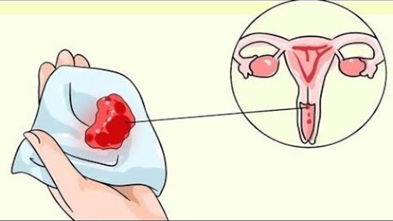 اعراض سرطان الرحم , العوامل التى تدل على ظهور سرطان الرحم