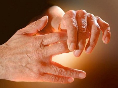 12674 علاج خدر اليدين - علاج تنميل اطراف اليد والقدم مساعد الطائف