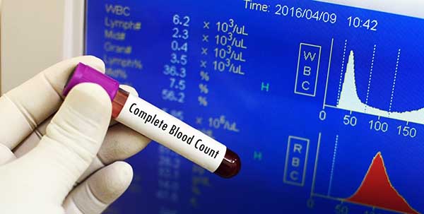 تحليل الدم الشامل ماذا يكشف